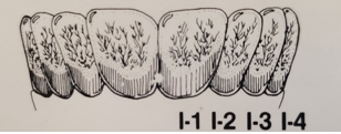 adult-elk-aging-cwd2