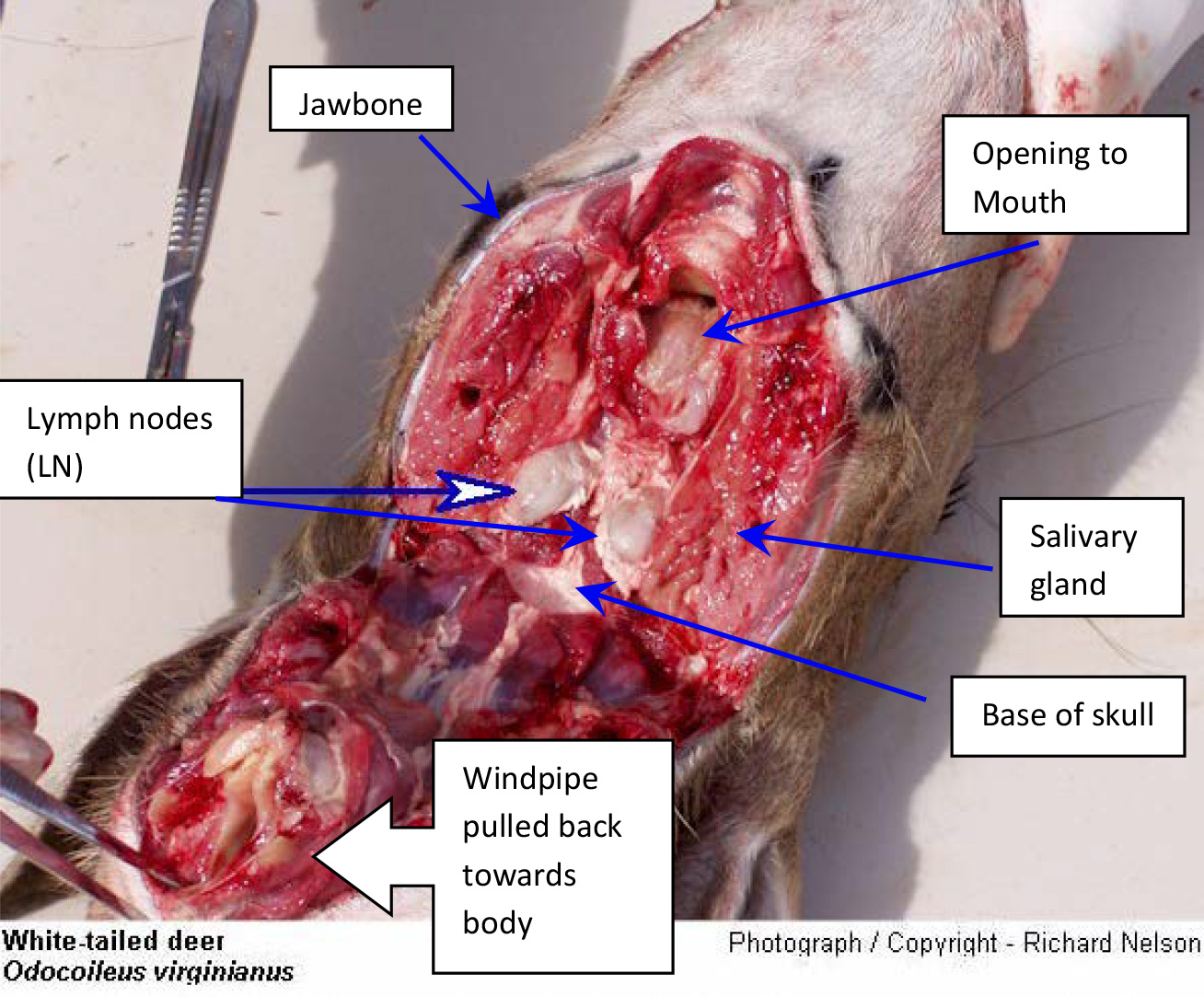 Lymph node collection diagram