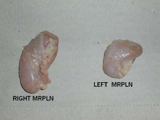 Lymph nodes