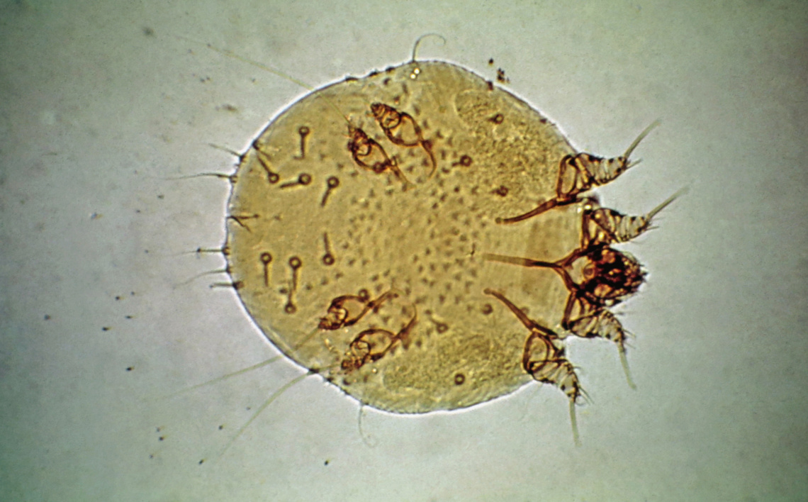 sarcoptes-spp-mange-mite-w-samuel-univ-alberta