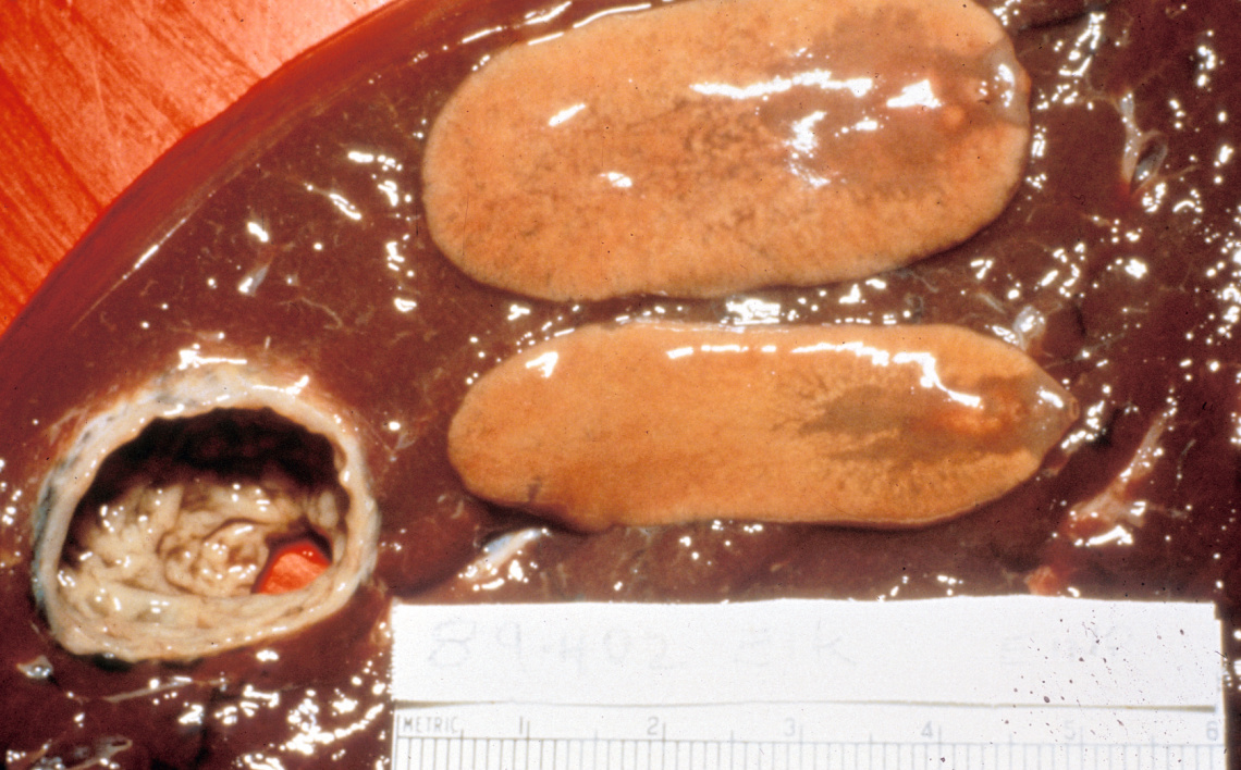Giant Liver Flukes Idaho Fish and Game