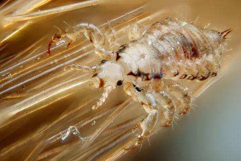 http://commons.wikimedia.org/wiki/File:Male_human_head_louse.jpg